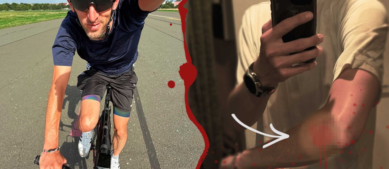 Mein Berlin-Trip endete im ASPHALT